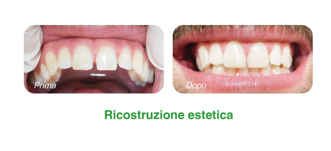 4___Tavola disegno 1_3